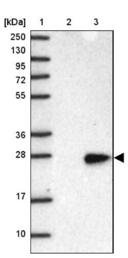 LHFPL5 Antibody, Novus Biologicals:Antibodies:Primary Antibodies